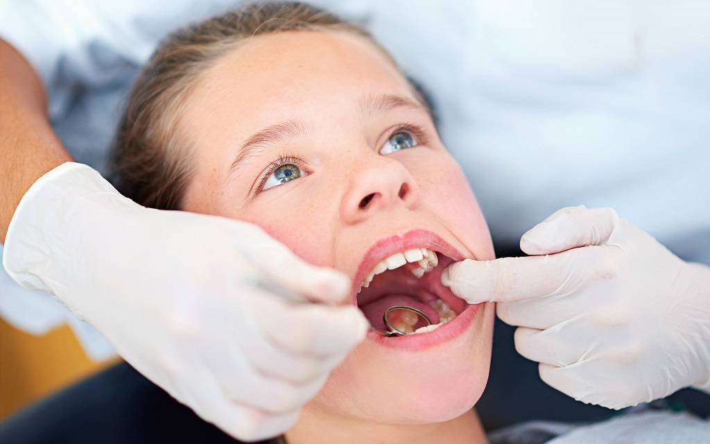 Ein Mädchen beim Zahnarzt mit weit offenem Mund. Hände mit weißen Handschuhen und einem Untersuchungsspiegel.