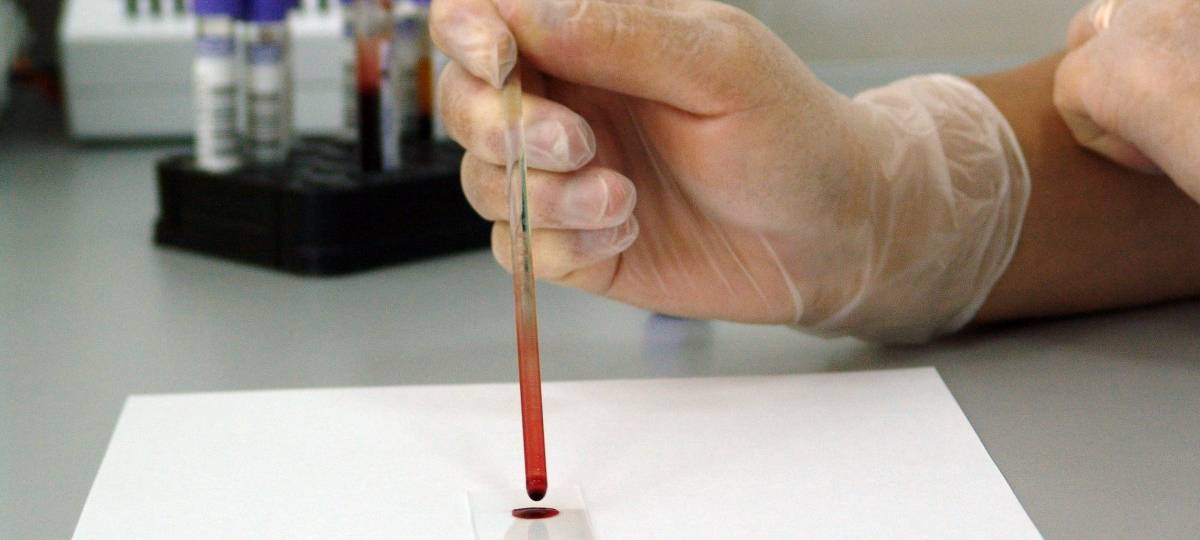 Karliczek: Neue Initiativen in der Nationalen Dekade gegen Krebs
