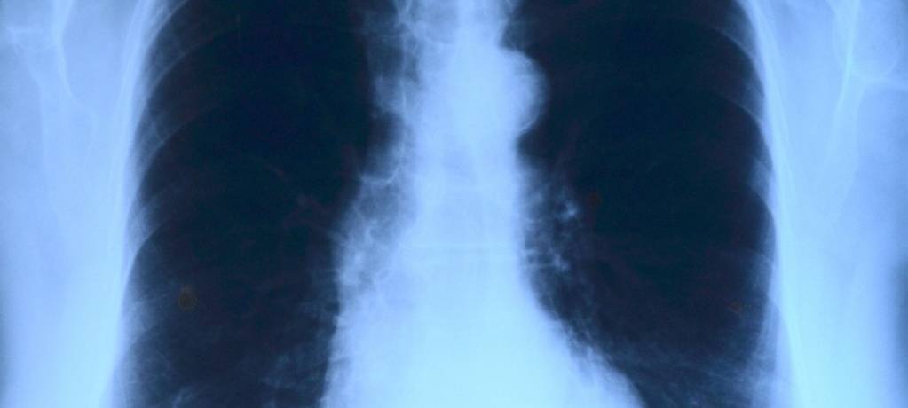 Lungenkrankheit COPD